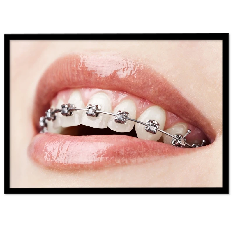 تابلو بکلیت طرح دندانپزشکی ارتودنسی مدل B-s319