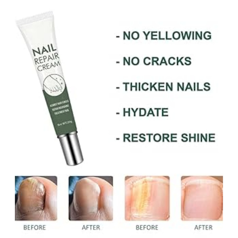کرم تقویت کننده و ترمیم کننده ناخن ایلهو مدل ضدقارچ وزن 20 گرم