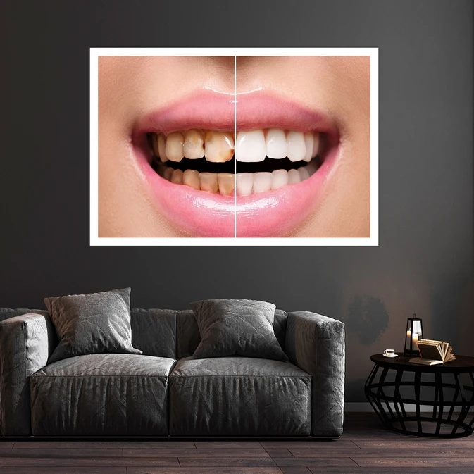 تابلو بکلیت طرح لبخند و دندانپزشکی مدل قاب شاسی W-s10153