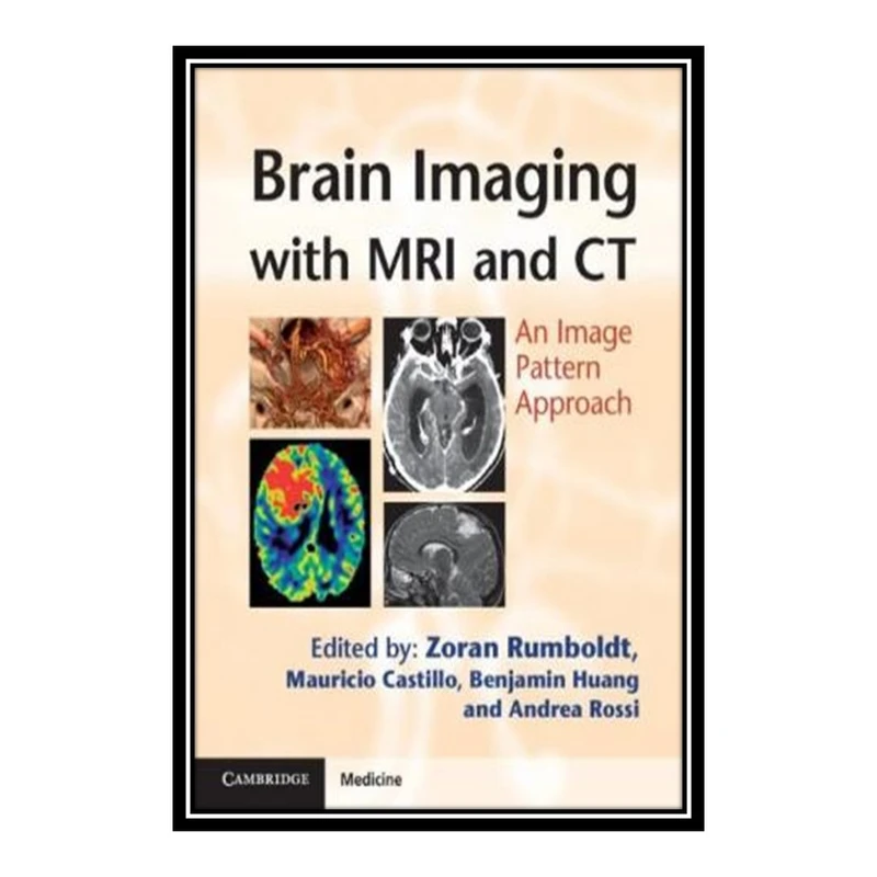 کتاب Brain Imaging with MRI and CT اثر Zoran Rumboldt et al انتشارات مؤلفین طلایی