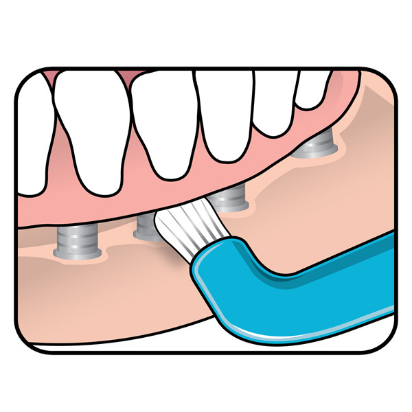 مسواک تهپه مدل Compact Tuft با برس نرم مسواک تهپه مدل Compact Tuft با برس نرم