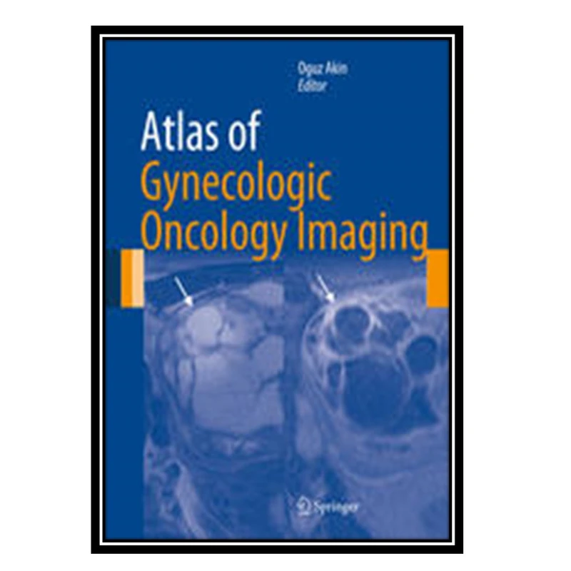 کتاب Atlas of Gynecologic Oncology Imaging اثر جمعی از نویسندگان انتشارات مؤلفین طلایی
