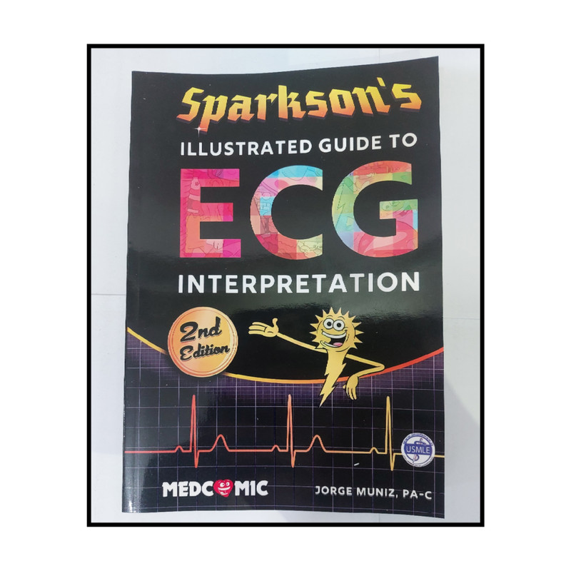 sparksons illustrated guide to ecg interpretation pdf download