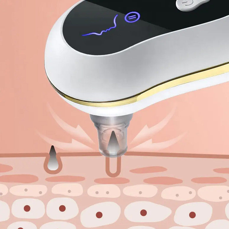 میکرودرم خانگی مدل SCRW-5 میکرودرم خانگی مدل SCRW-5