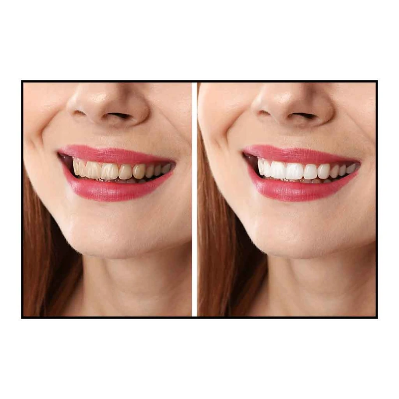 فرش پارچه‌ای مدل فرشینه طرح بلیچینگ دندان  سفید و درخشان‌ کد AR3061457
