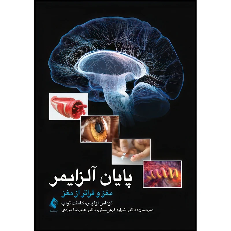 کتاب پایان آلزایمر مغز و فراتر از مغز اثر توماس جی. لوئیس و کلمنت ترمپ ترجمه دکتر شراره فرهیمنش  و دکتر علیرضا مرادی انتشارات ارجمند