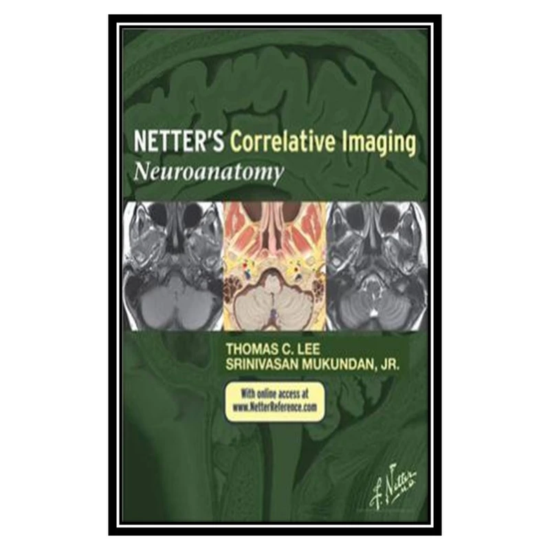 کتاب Netter’s Correlative Imaging اثر جمعی از نویسندگان انتشارات مؤلفین طلایی