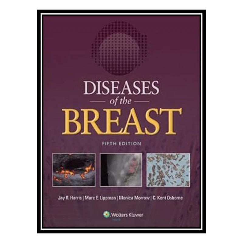 کتاب Diseases of the Breast اثر جمعی از نویسندگان انتشارات مؤلفین طلایی
