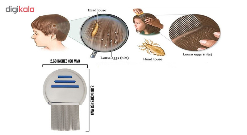 شانه ضد شپش کد 01