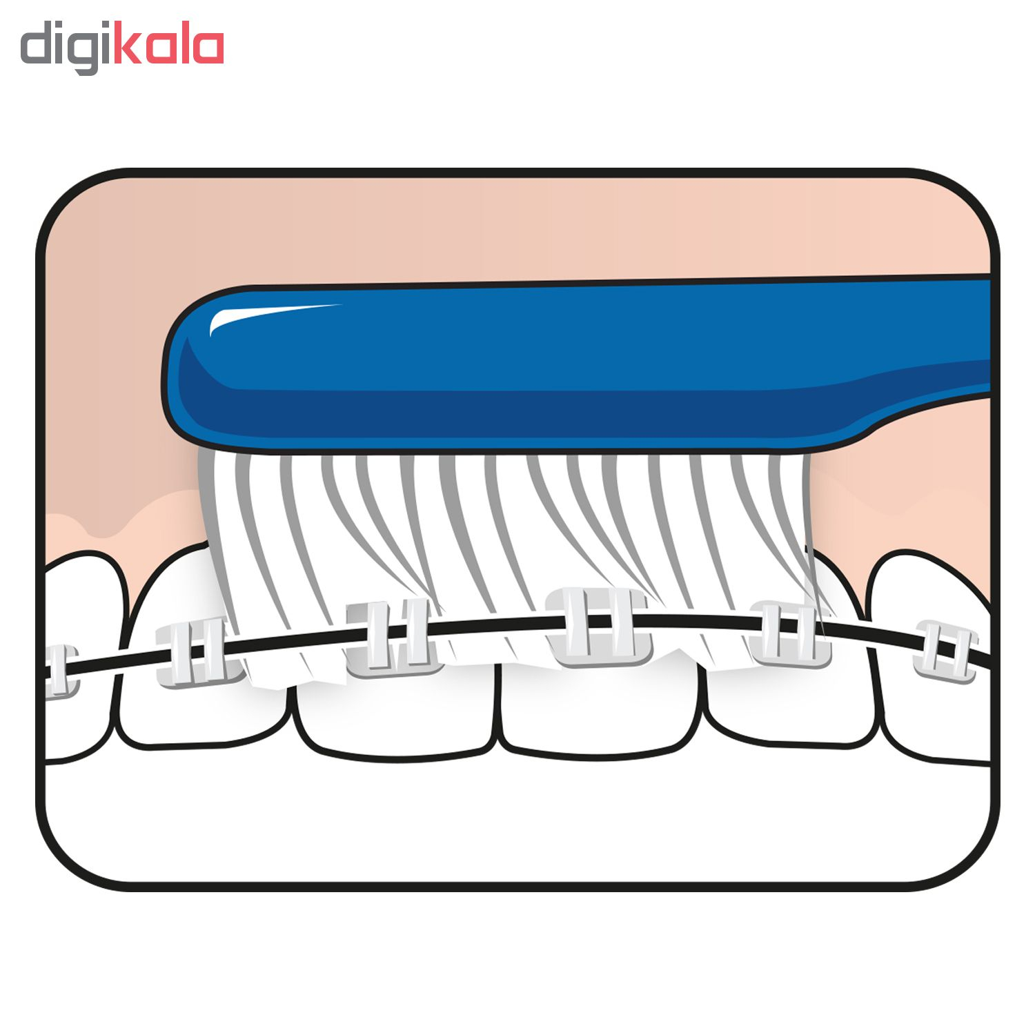 مسواک ته‌په مدل Implant Ortho با برس متوسط