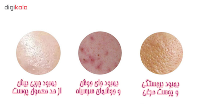 برس پاکسازی پاریس استایل مدل MT1 برس پاکسازی پاریس استایل مدل MT1
