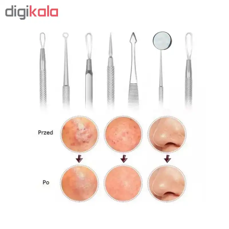 مجموعه ابزار پاک‌سازی پوست کیو وای اچ مدل derm-3198 بسته 7 عددی