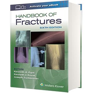 کتاب Handbook of Fractures اثر جمعی از نویسندگان انتشارات لیپین کات