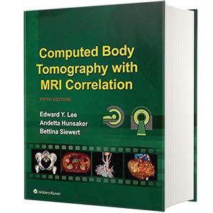 کتاب Computed Body Tomography with MRI Correlation اثر جمعی از نویسندگان انتشارات لیپین کات
