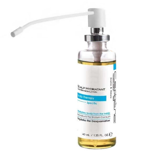 لوسیون مو سپیژن مدل dry scalp حجم 40 میلی لیتر