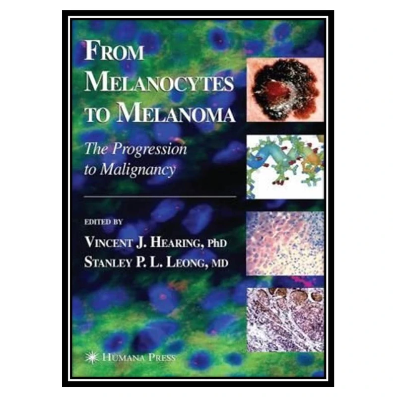 کتاب From melanocytes to melanoma اثر جمعی از نویسندگان انتشارات مؤلفین طلایی