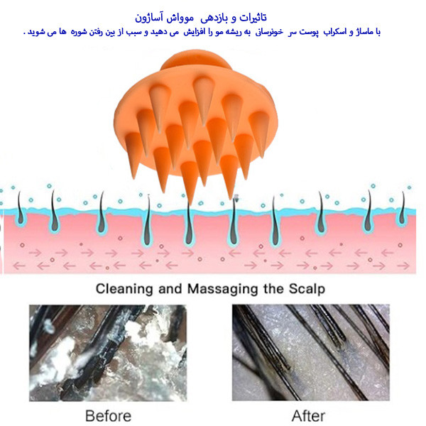 ماساژور سر  آساژون مدل MooWash
