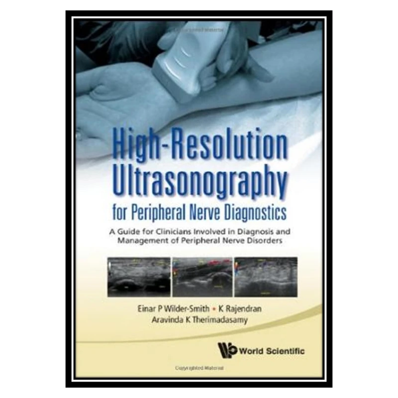 کتاب High-resolution Ultrasonography اثر جمعی از نویسندگان انتشارات مؤلفین طلایی