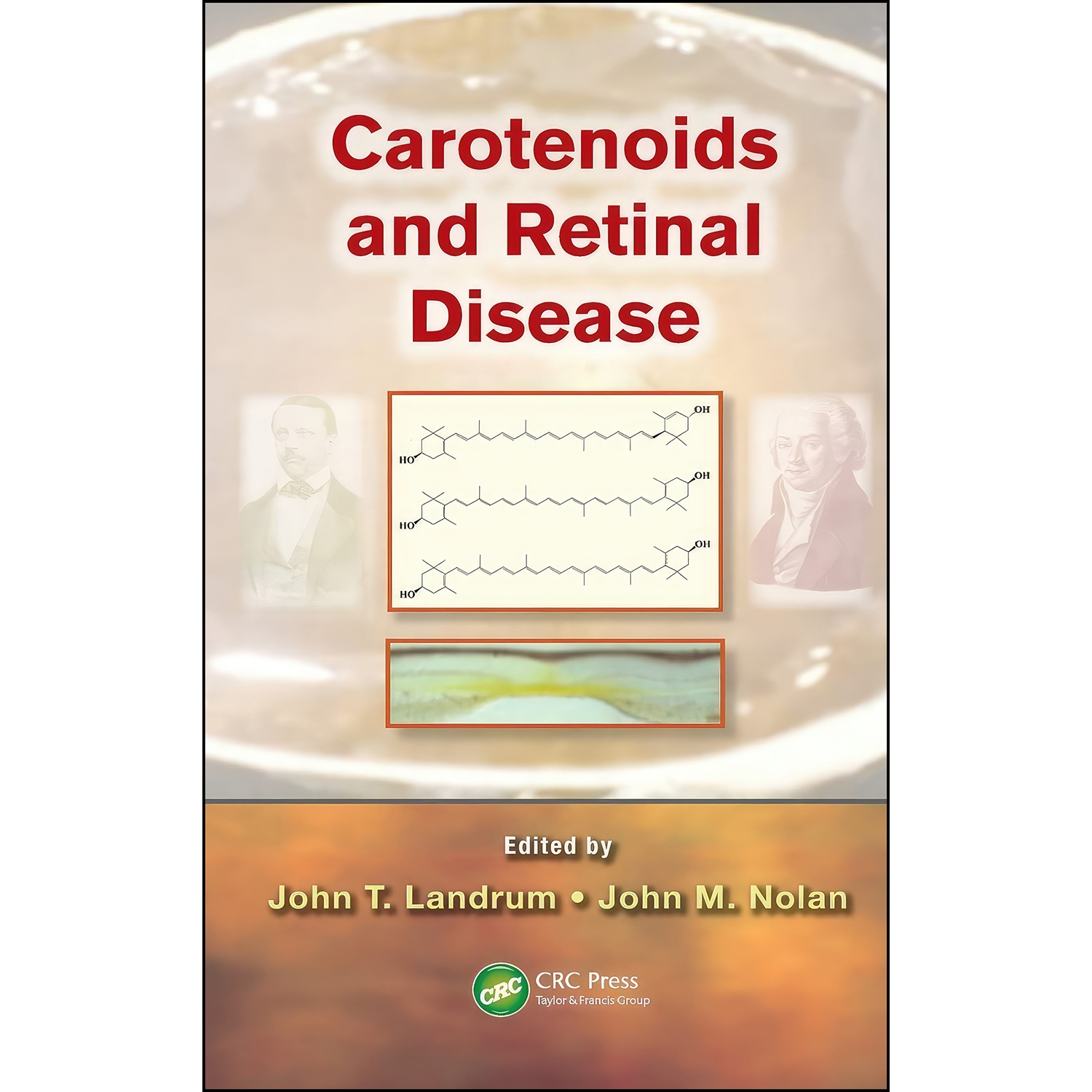 کتاب Carotenoids and Retinal Disease اثر John T. Landrum and John Nolan انتشارات CRC Press