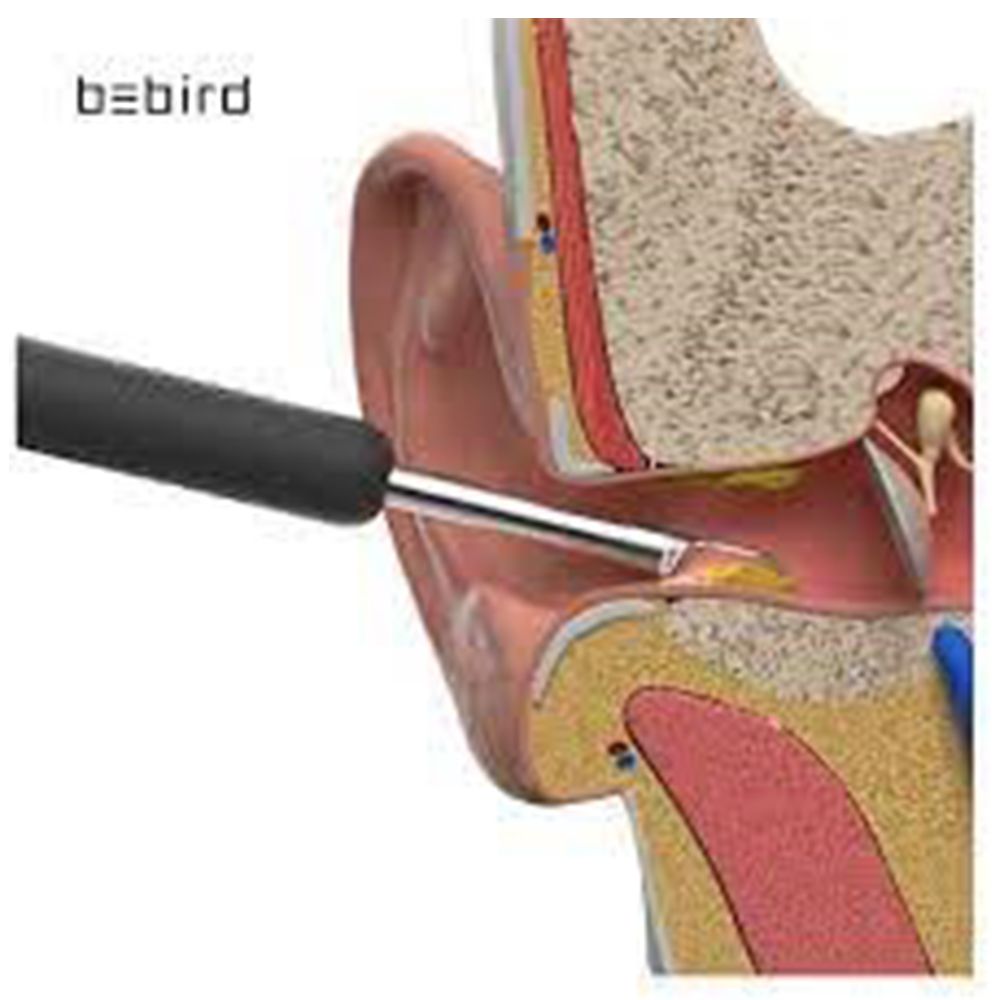 گوش پاک کن هوشمند شیائومی مدل Bebird R1 -  - 5