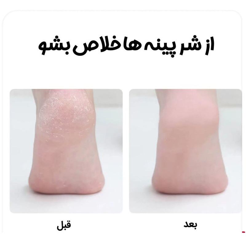 سنگ پا برقی دوکو مدل F001