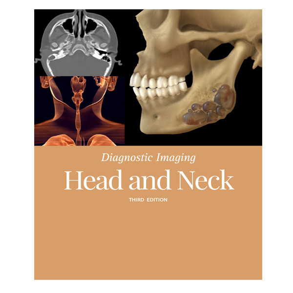 قیمت و خرید کتاب Diagnostic ImagingHead and Neck اثر KOCH HAMILTON