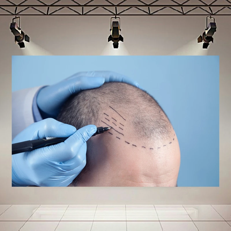 پوستر دیواری طرح کاشت مو مدل مردانه کد AR304400