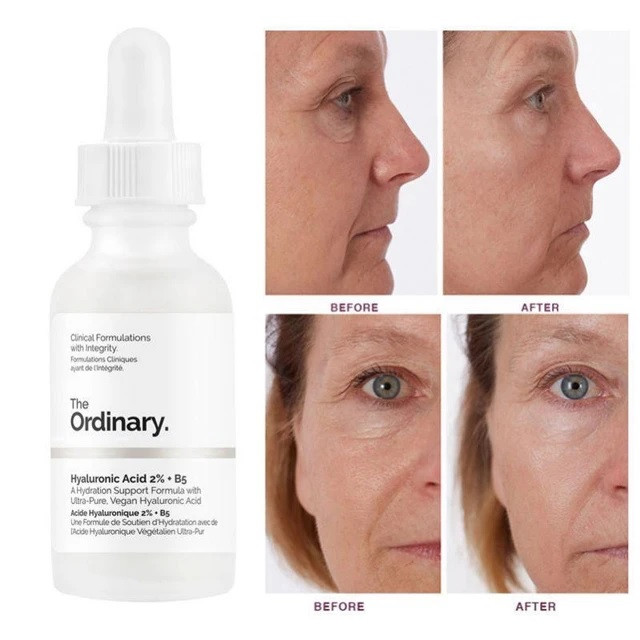 سرم دی اوردینری مدل Hyaluronic Acid حجم 60 میلی لیتر سرم دی اوردینری مدل Hyaluronic Acid حجم 60 میلی لیتر
