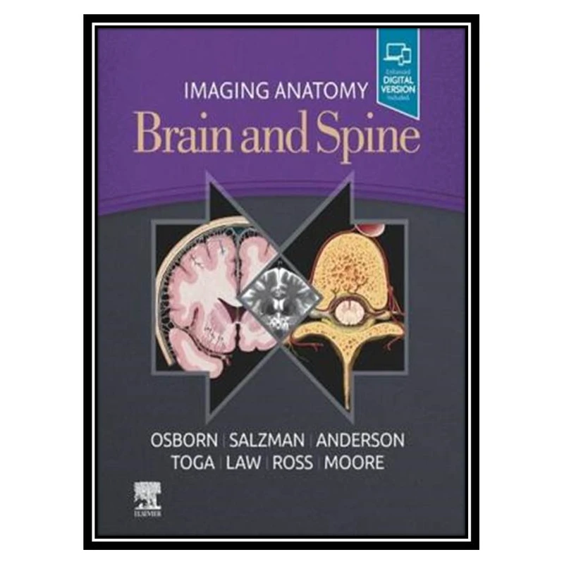کتاب Imaging Anatomy Brain and Spine اثر جمعی از نویسندگان انتشارات مؤلفین طلایی