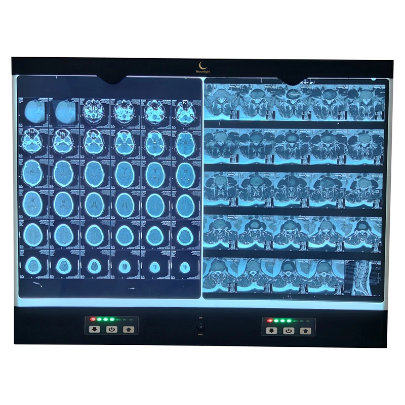 نگاتوسکوپ مون لایت مدل ML2