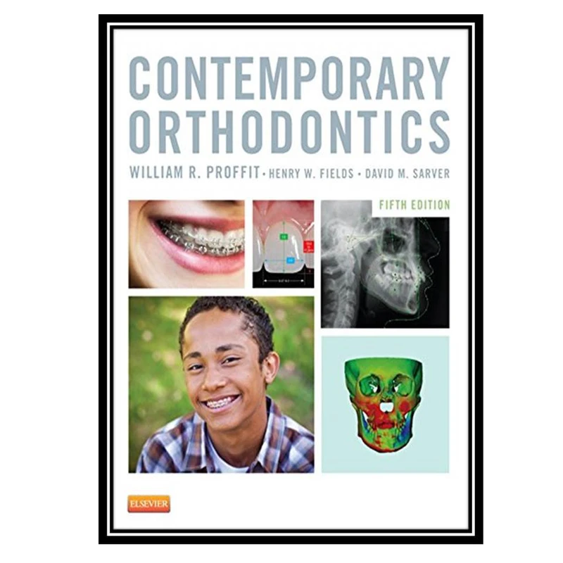 کتاب Contemporary Orthodontics اثر جمعی از نویسندگان انتشارات مؤلفین طلایی