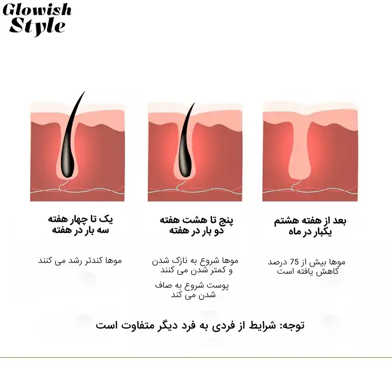 لیزر موهای زائد گلویش استایل مدل Level5