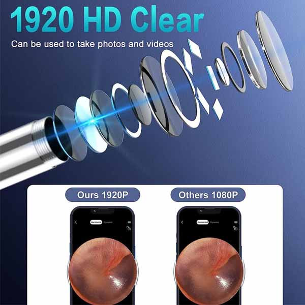 اتوسکوپ دیجیتال مدل  3368