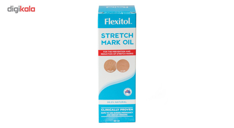 روغن رفع ترک پوست فلکسیتول مدل STRECH MARK OIL حجم 60 میلی لیتر