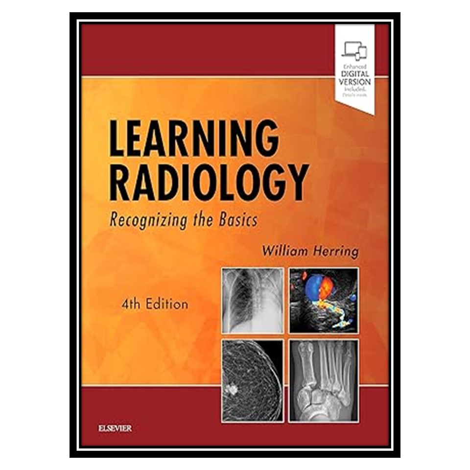 Learning Radiology: Recognizing the Basics [ペーパーバック] Herring MD  FACR，William 817R9kFZ+zL._UF350,350_QL50_.jpg