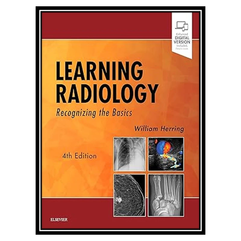 کتاب Learning Radiology: Recognizing the Basics اثر William Herring انتشارات مؤلفین طلایی