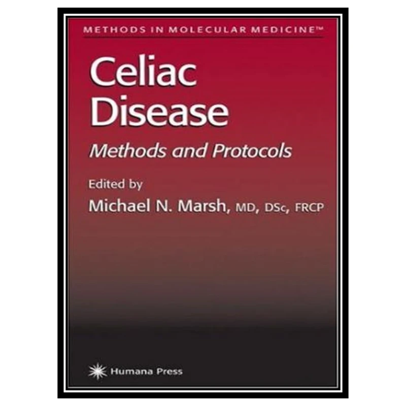 کتاب Celiac Disease: Methods and Protocols اثر Michael N. Marsh انتشارات مؤلفین طلایی
