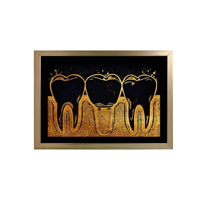 تابلو نقاشی اکریلیک طرح دندانپزشکی کد dec22