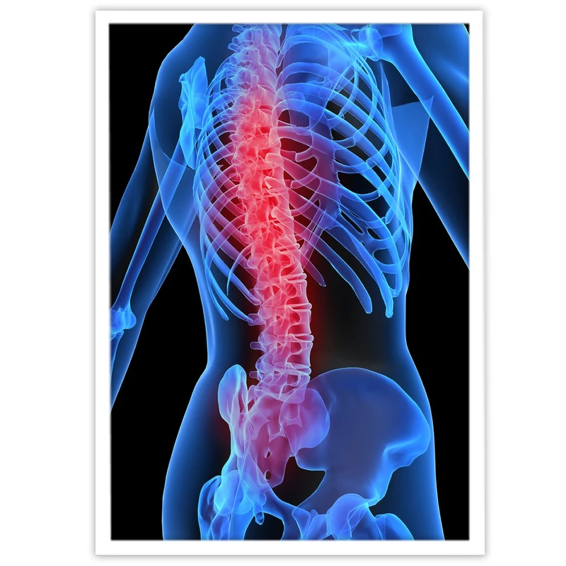 تابلو نوری بکلیت طرح رادیوگرافی و رادیولوژی مدل W-8679