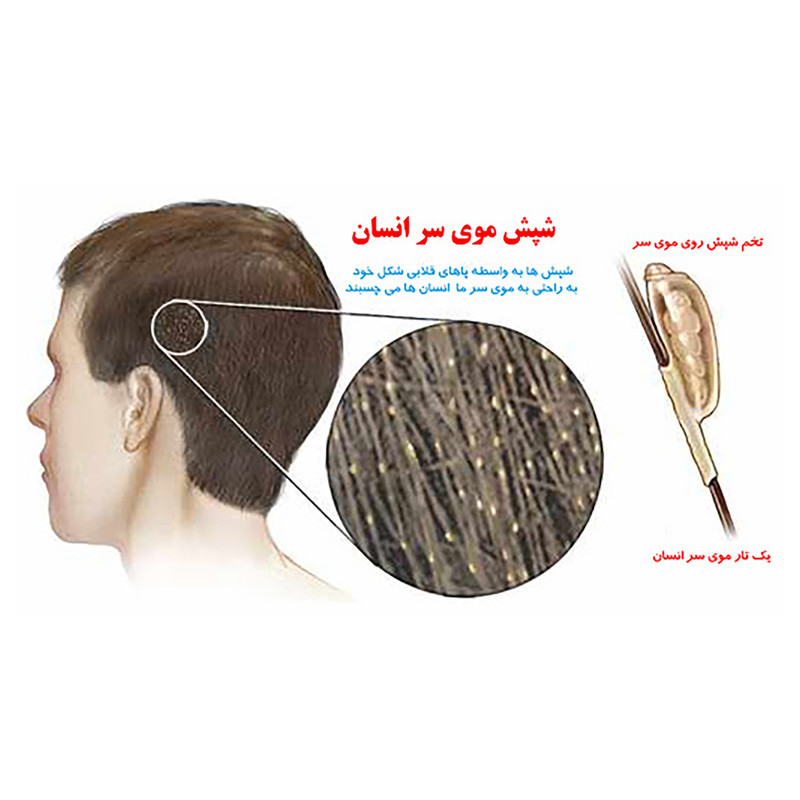 پودر شپش کش هلاک مدل Louse Killer وزن 100 گرم