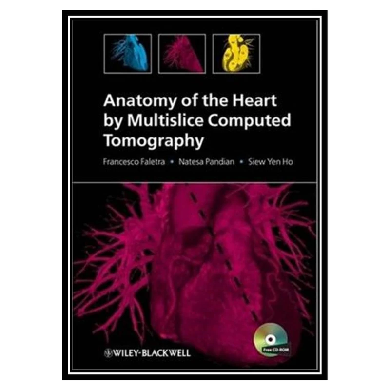 کتاب Anatomy of the Heart by Multislice Computed Tomography اثر جمعی از نویسندگان انتشارات مؤلفین طلایی