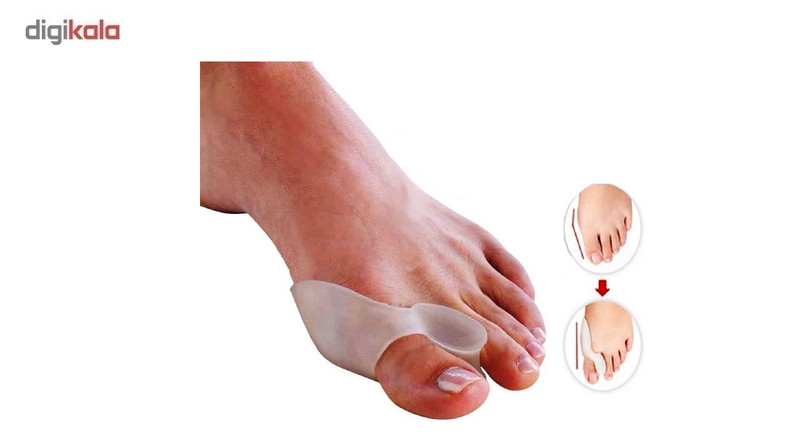 فاصله دهنده سیلیکونی ساپورت دار انگشت شست مدل S-012