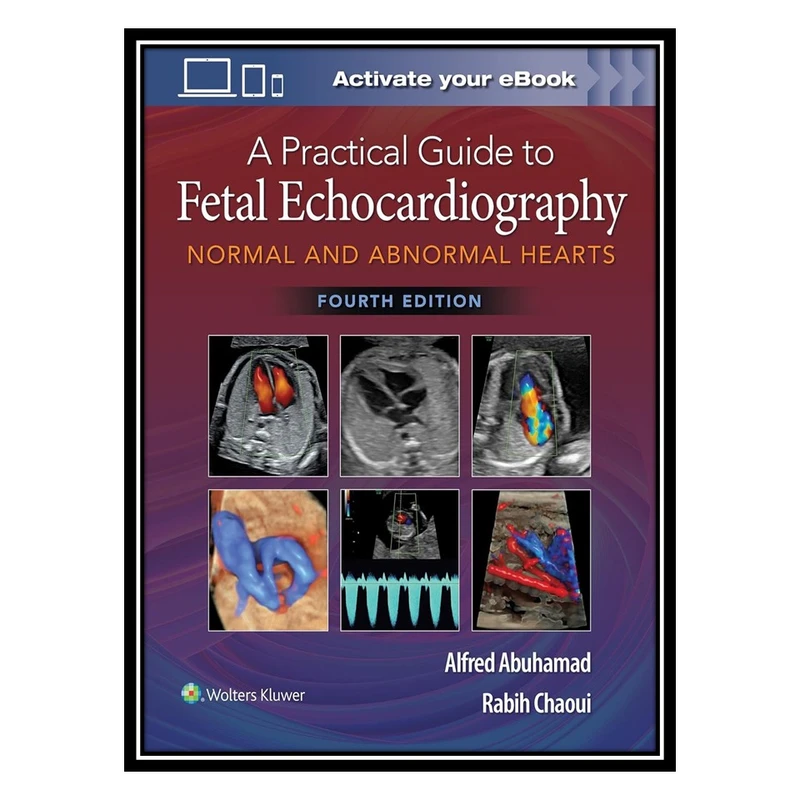 کتاب A Practical Guide to Fetal Echocardiography: Normal and Abnormal Hearts اثر Alfred Z. Abuhamad , Rabih Chaoui انتشارات مؤلفین طلایی
