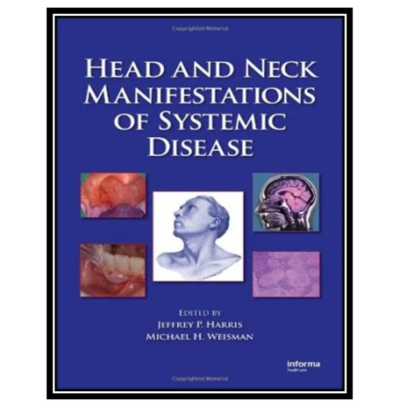 کتاب Head and Neck Manifestations of Systemic Disease اثر P. Harris Jeffrey and Michael H. Weisman انتشارات مؤلفین طلایی