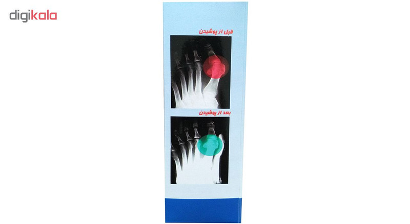 اصلاح کننده انگشت پا مدل HV