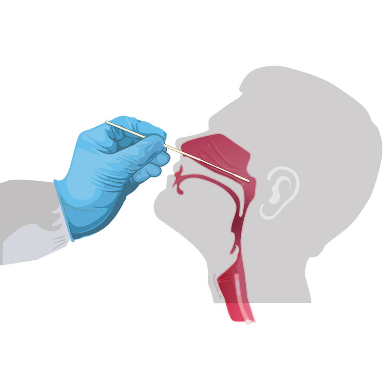 تست سریع کرونا دیابیس مدل 15min بسته 3 عددی