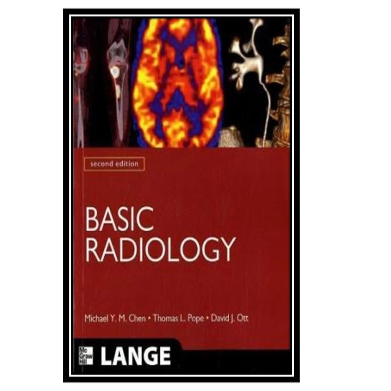 کتاب Basic Radiology اثر جمعی از نویسندگان انتشارات مؤلفین طلایی