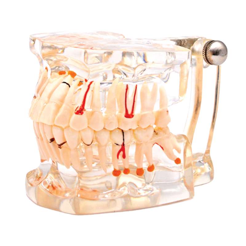 بازی آموزشی مدل مولاژ دندان طرح شیشه ای کد A020