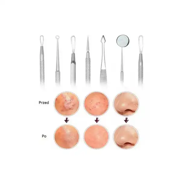 قلم پاکسازی پوست مدل Q10 مجموعه 7 عددی