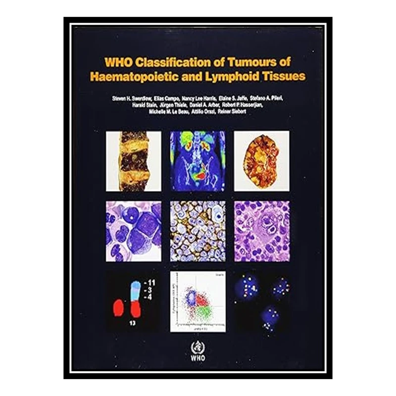 کتاب WHO Classification of Tumours of Haematopoietic and Lymphoid Tissues اثر جمعی از نویسندگان انتشارات مؤلفین طلایی
